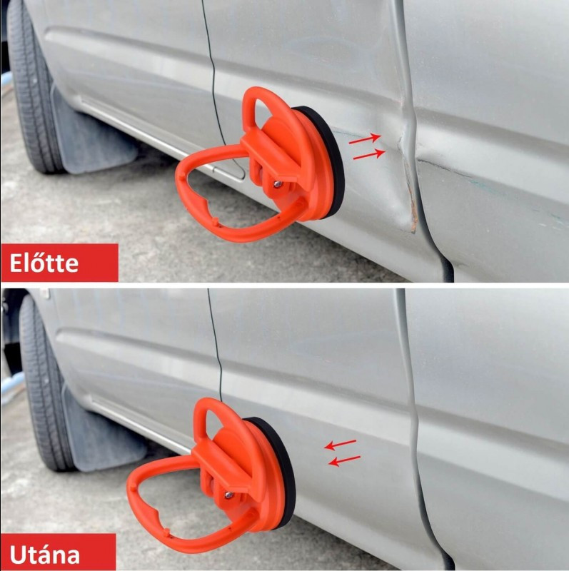 Horpadásjavító tapadókorong - Image 8